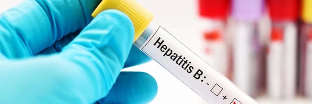 Hepatit: simptomlar, növlər və müalicələr-qaraciyər sağlamlığı üçün nələri bilməlisiniz