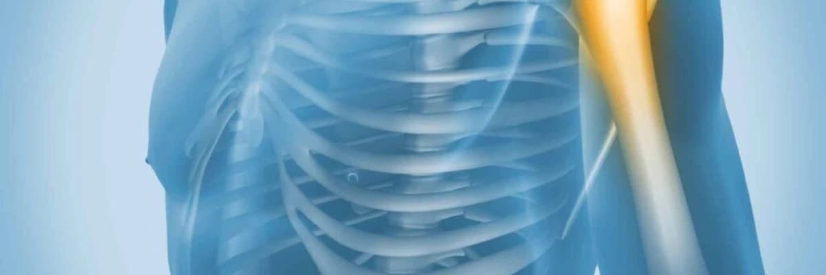 Xroniki çiyin ağrıları