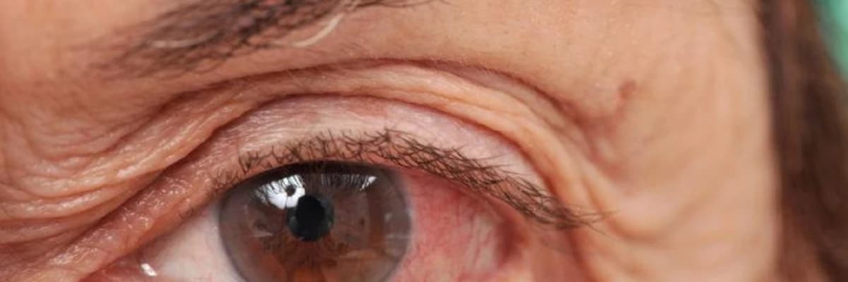 Görmə sahəsinin daralması və görmə itkisi