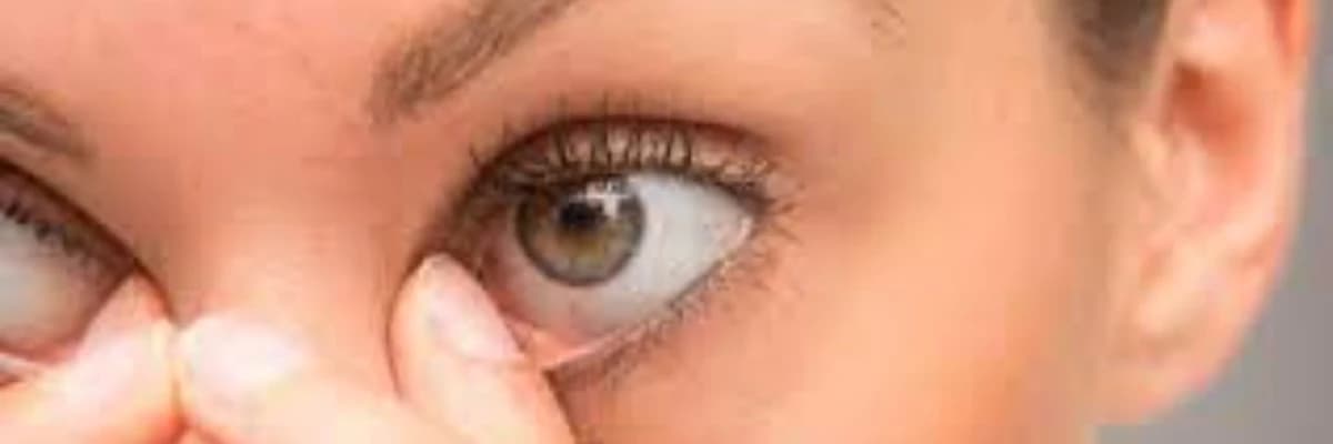 Gözdə qaşınma və yanğı hissi