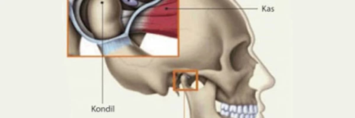 Temporomandibular Oynağın (TMJ) Pozğunluqları: Səbəbləri, Simptomları və Müalicə Yolları