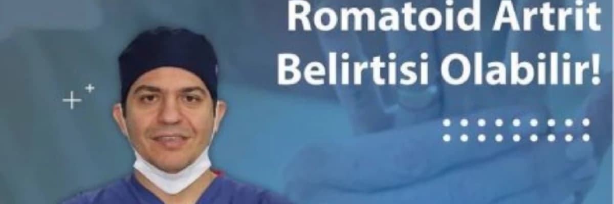 Oynaqlarda təkrarlanan şişlik romatoid artritin əlaməti ola bilər