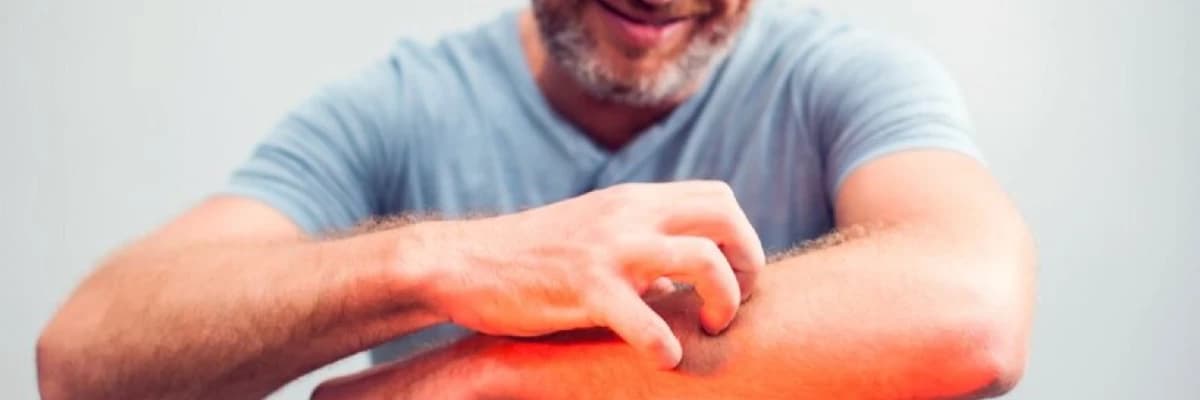 Xroniki Qaşınma: Səbəbləri, Təsirləri və Müalicə Yolları