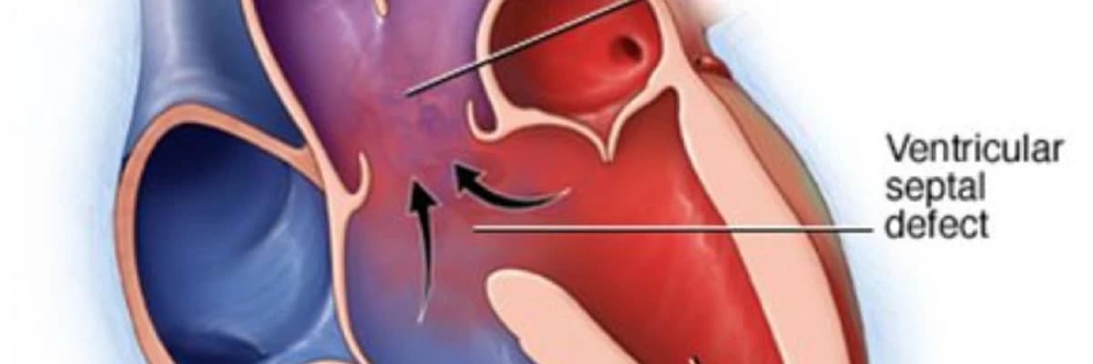 Trunkus Arteriyozus