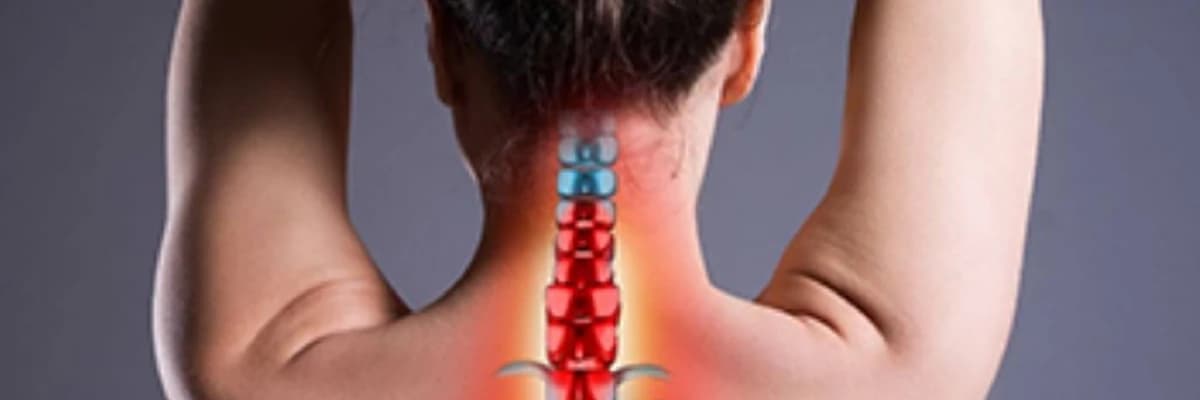 Servikal və Bel Yırtığı (Disk Herniasiyası): Tərif, Səbəbləri və Müalicə Yolları