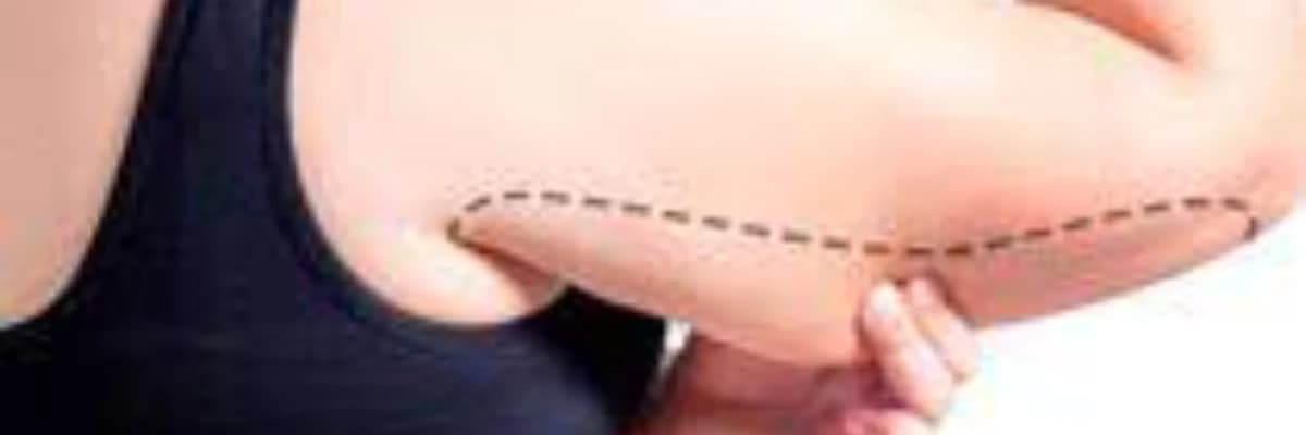 Qollarin liposaksiyasi