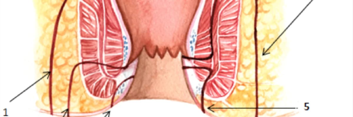 Anal çat xəstəliyi