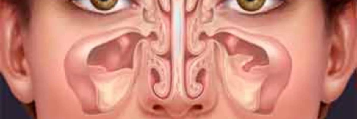 Endoskopik Sinus Cərrahiyyəsi Haqqında Məlumat