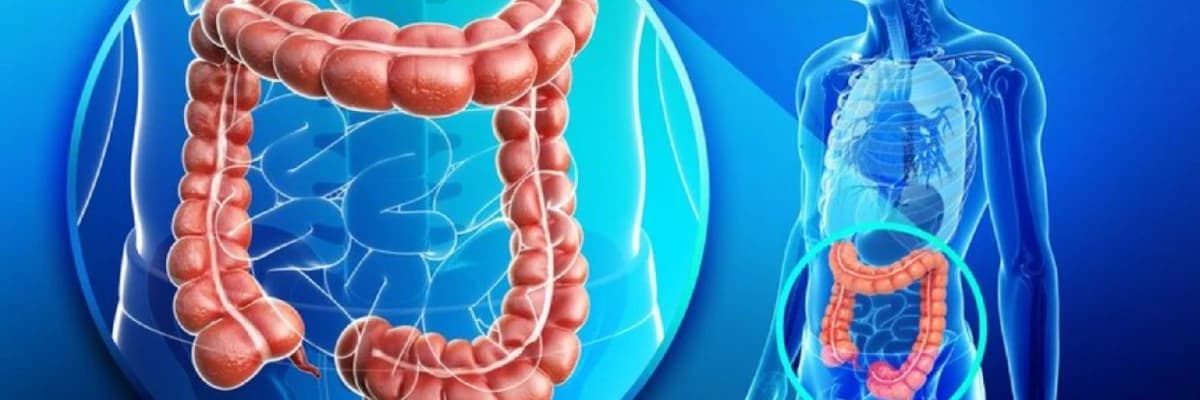 Qapalı Kolon Xərçəngi Əməliyyatları