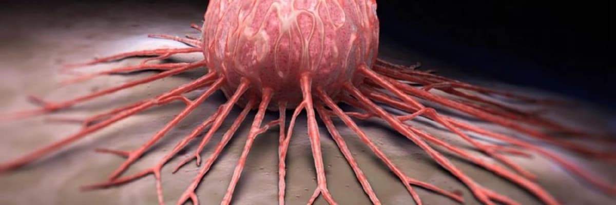 Qidalanmada Xərçəng: