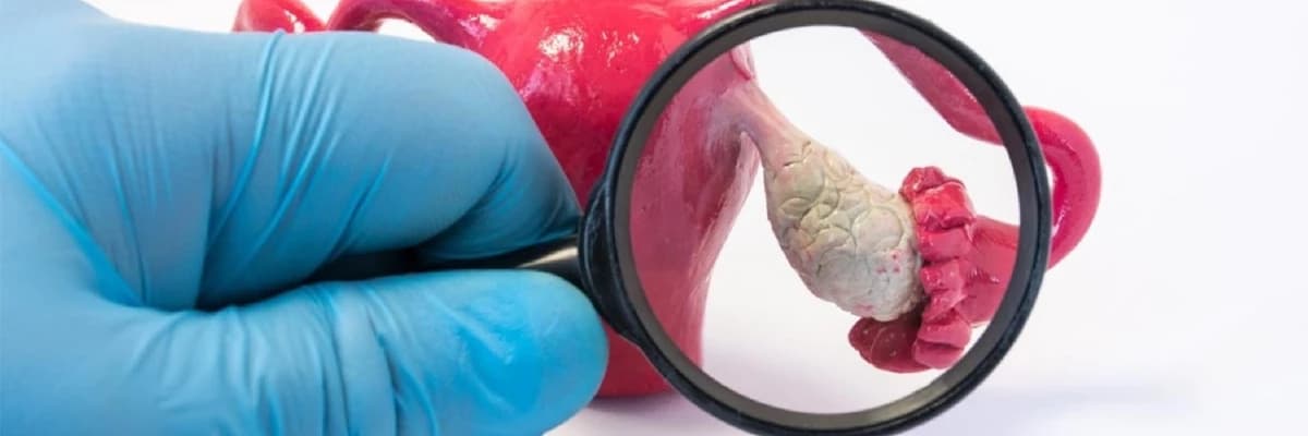 Endometrioz