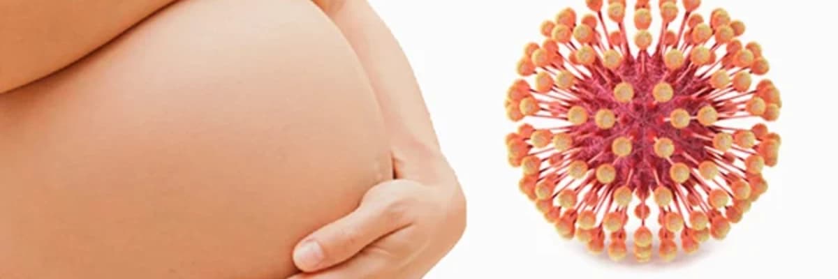 Perinatal infeksiyalar (TORCH)