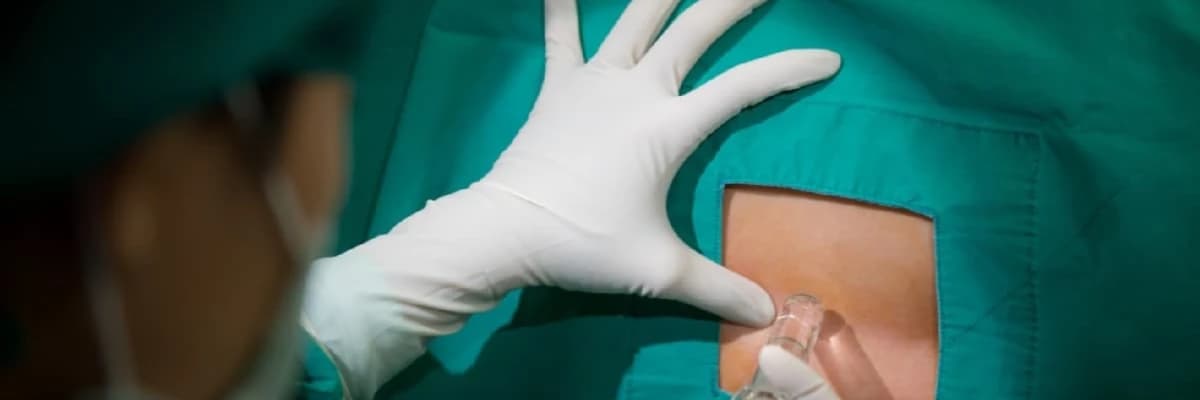 Qeysəriyyə əməliyyatı (epidural, spinal, gen anesteziyası)