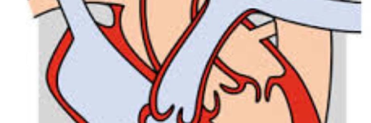 Aorta-Pulmoner pencere