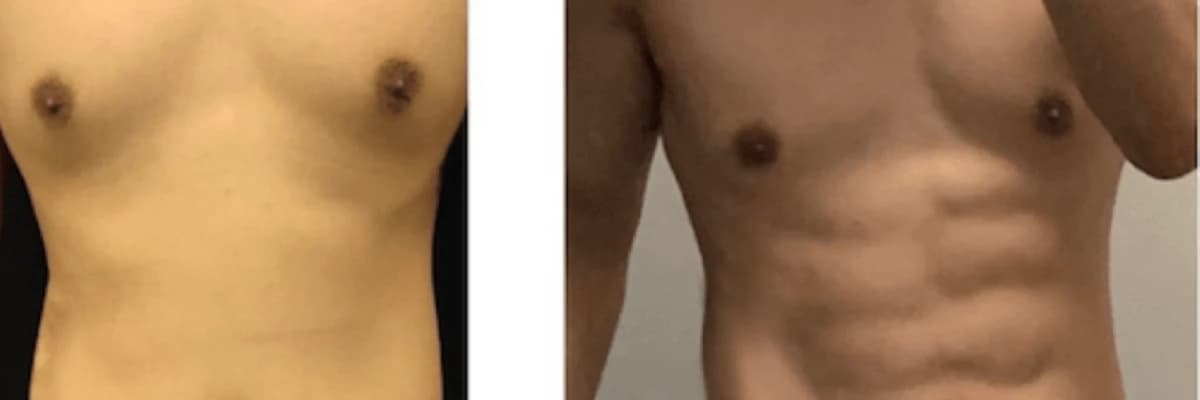 6 pack lipo