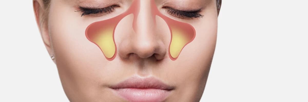 Endoskopik Sinus Cərrahiyyəsi