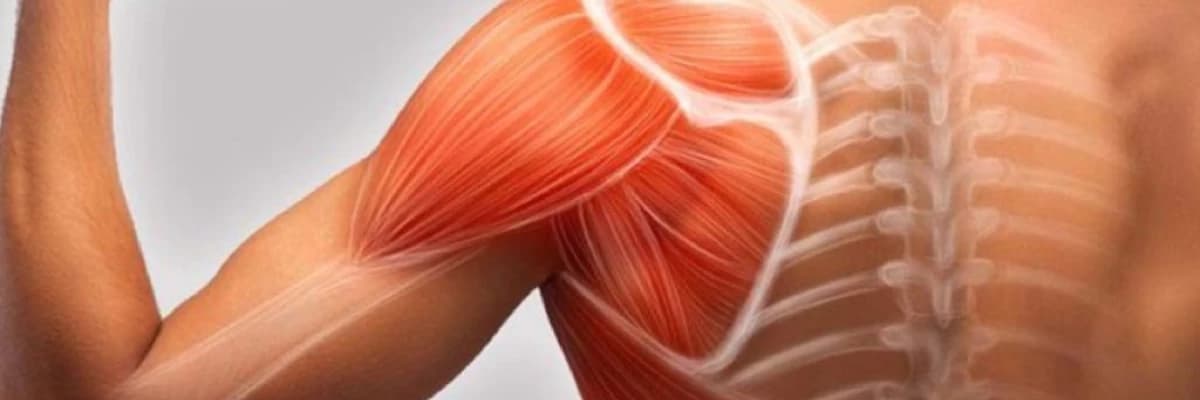 Əzələ ağrıları (fibromialgiya, miofasial ağrılar)