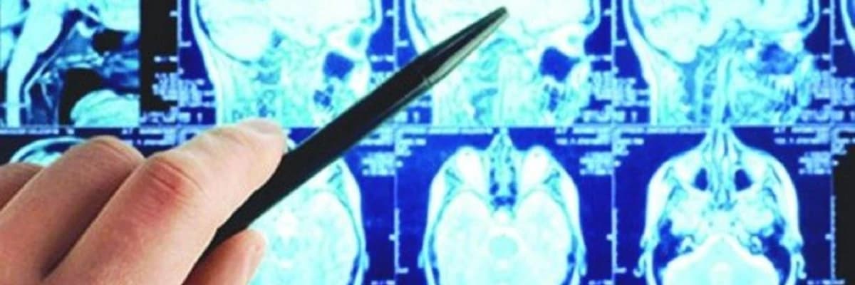 Onurğa Beyni Şişləri (Spinal Tümorlar): Tərif, Səbəbləri və Müalicə Yolları