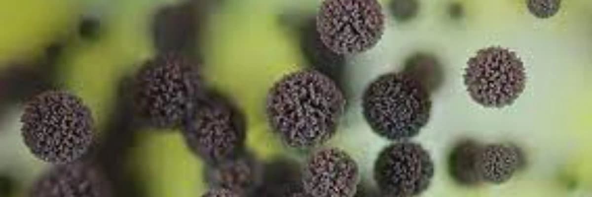 Allergik bronxopulmonal aspergilyoz