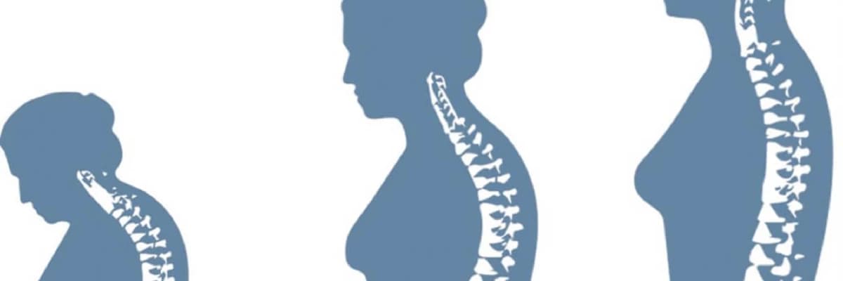 Osteoporoz