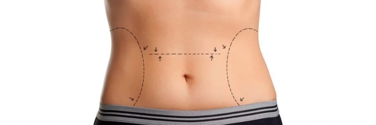 Bel Təlimi: Arıqlama və Bədən Formasının Tənzimlənməsi