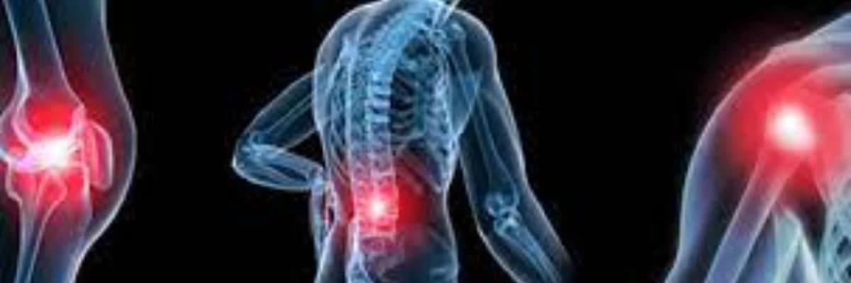 Əhənglənmə (osteoartrit)