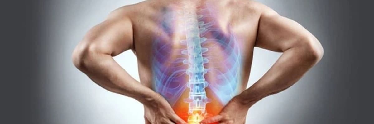 Bel Ağrısı, Risk Faktorları və Müalicə Prosesi Haqqında