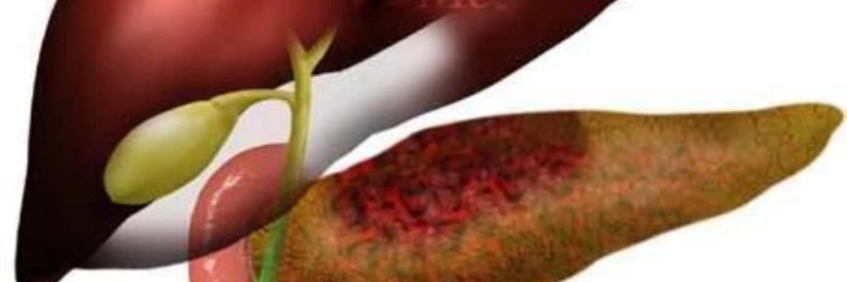 Qaraciyər-öd yolları,öd kisəsi, mədaltı vəz,dalağın cərrahi xəstəlikləri