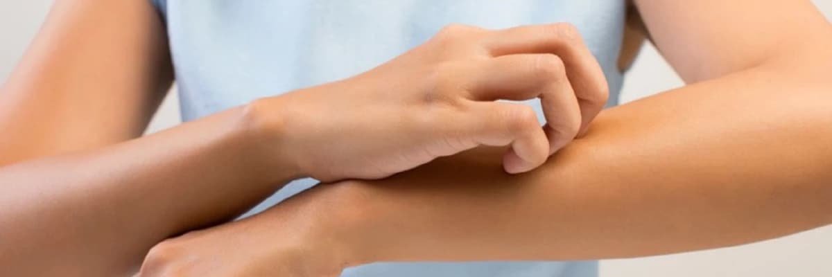 Qaşıntı (Pruritus)