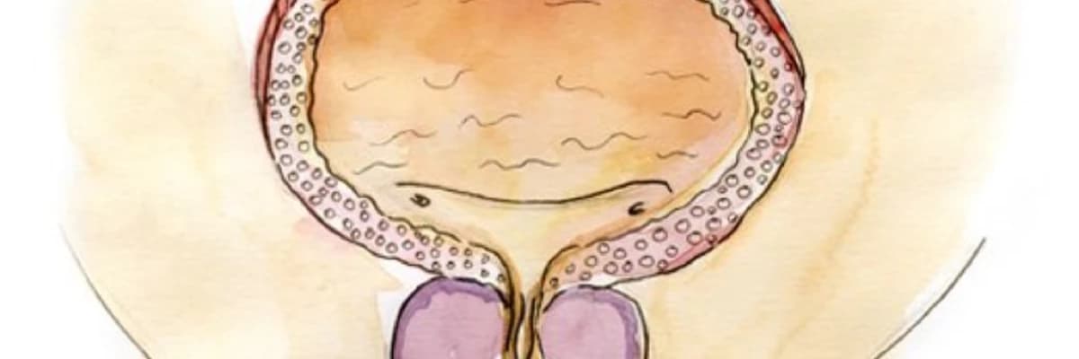 Xoşxassəli prostat böyüməsi və onun cinsi sağlamlığa təsiri