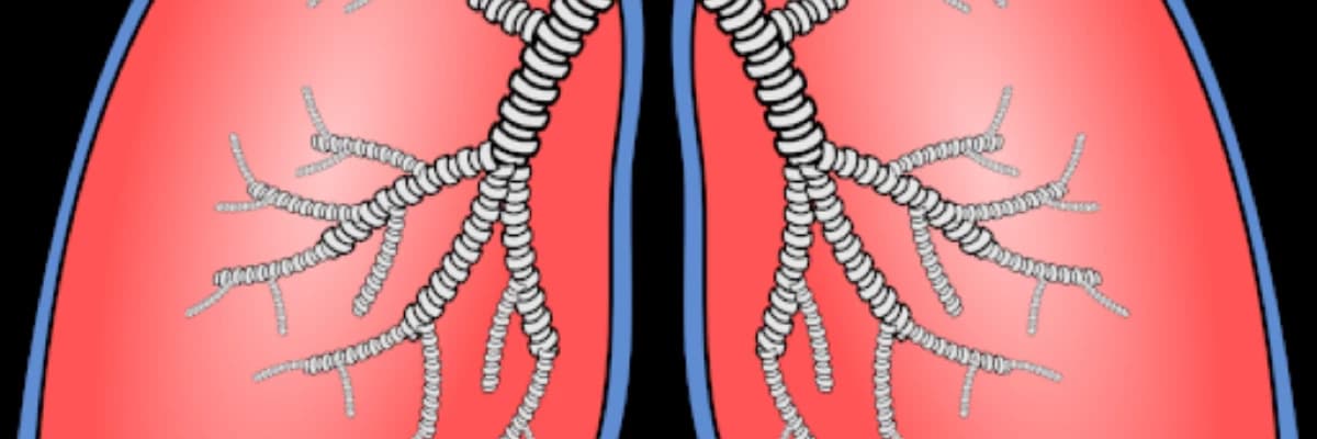 Ağciyər emboliyası