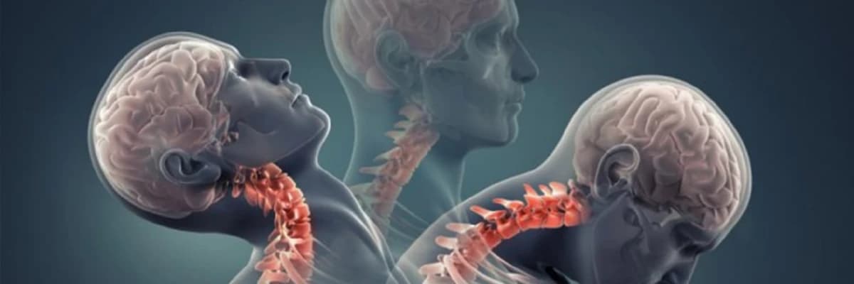 Boyun və bel yırtıqları: səbəbləri, simptomları və müalicə üsulları