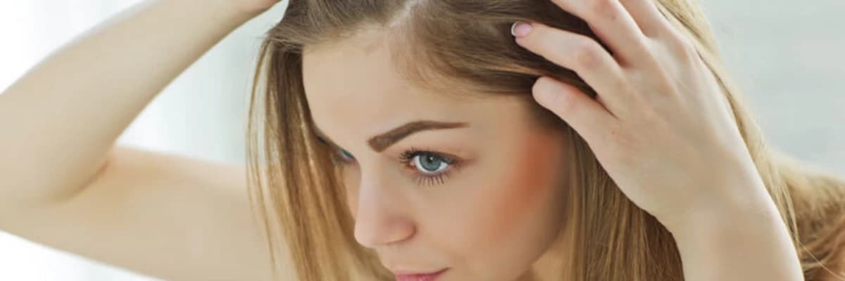 Qadınlarda saç tökülməsinin səbəbləri