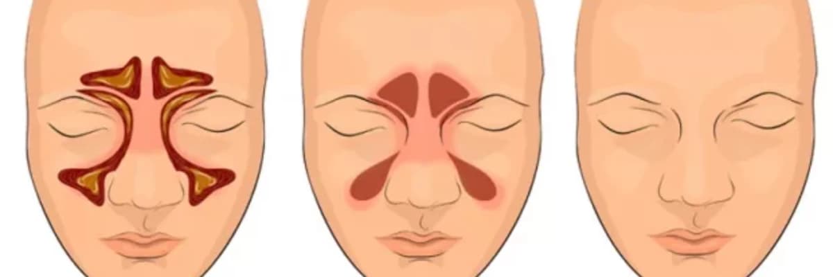 Burun qüsurları, şişlər, yırtıqlar
