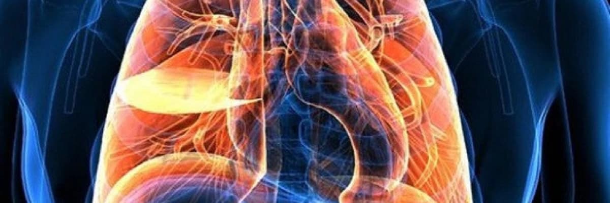 Ağciyər Xərçəngi: Simptomları, Səbəbləri və Müalicəsi