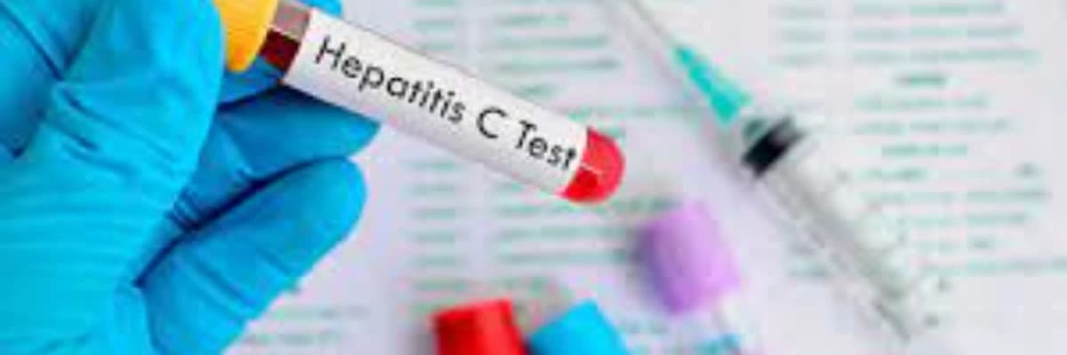 Hepatit C-nin zamanında düzgün müalicəsi