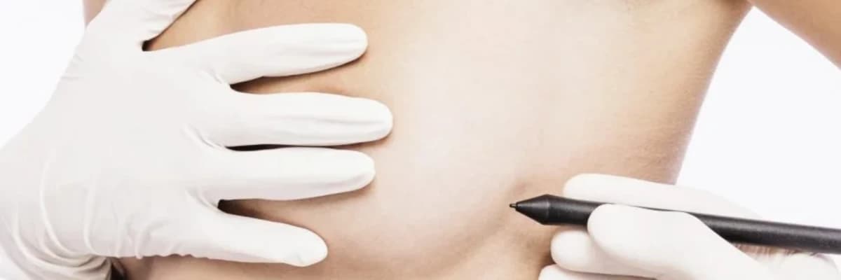 Süd vəzi rekonstruksiyası