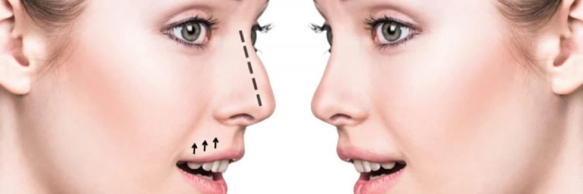 Adenoid-Tonsil Cərrahisi
