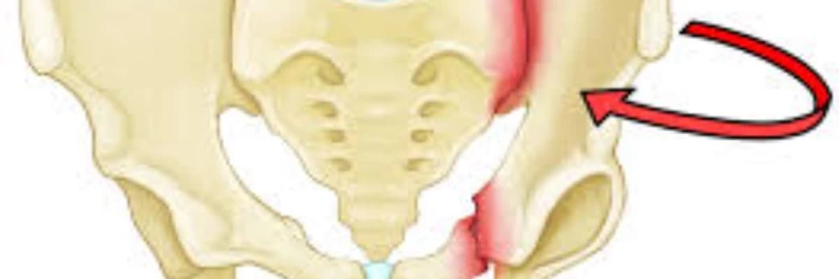 Hər növ sümük sınıqları