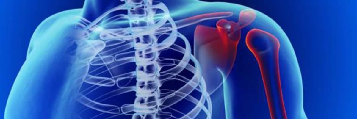 Əzələ və bağ dartınmaları və yırtıqları