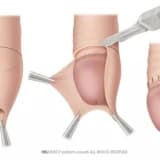 Sünnət faydalıdır, Amma