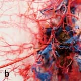 Endometrium transplantologiyası