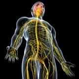 Periferik sinir problemləri, travmalar, neyropatiyalar, qüsurlar, kütlələr