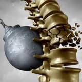 Osteoporozun (sümük kütləsinin azalması), osteonekrozların (AVN) diaqnostika və müalicəsi