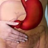 Mədə Ağrıları: Səbəbləri, Simptomları və Müalicə Yolları
