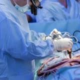 Artık Açık Kalp Ameliyatı Olmayacak