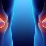 Artrit: nədir, simptomları və müalicəsi