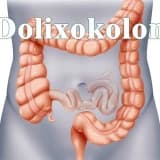 Dolixokolon haqqında