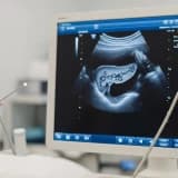 Endosonoqrafiya nədir?