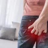 Anal stenoz